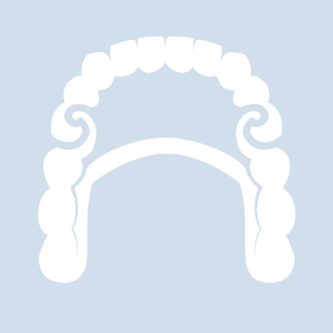 Geschiebeprothese Abbildung einer Geschiebeprothese